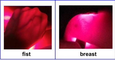 Red light shines through a fist and breast tissue.