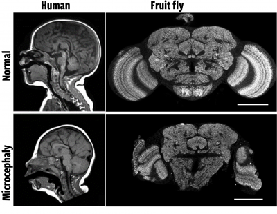 black and white images of brains