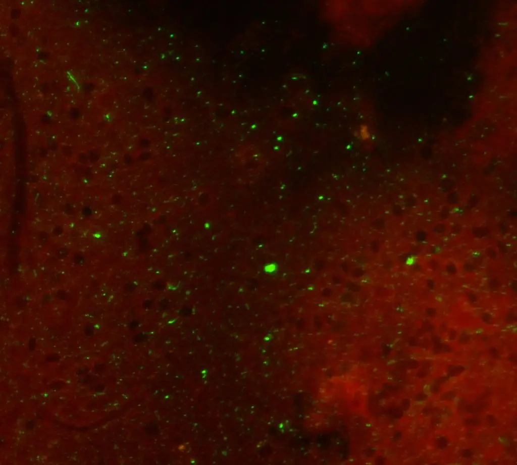 Microscopic image of animal tissue with fluorescent green stains that indicate the presence of the rabies virus