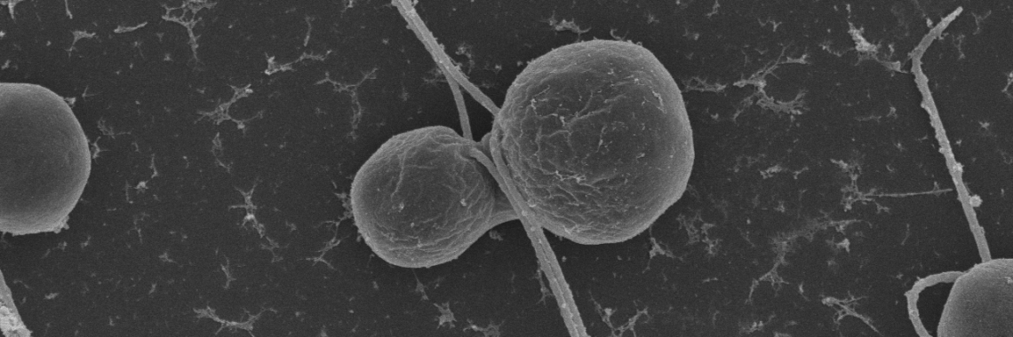 A microscope image of two Chlamydomonas gametes fusing together.