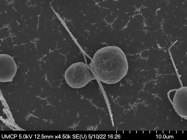 A microscope image of two Chlamydomonas gametes fusing together.