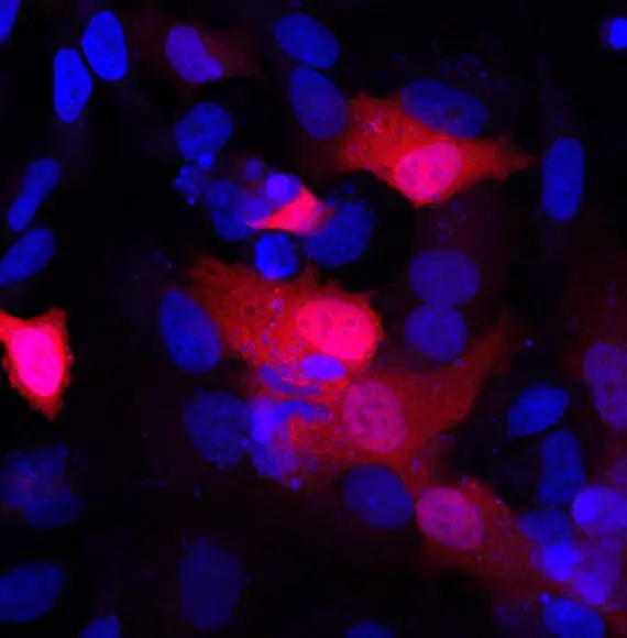 Proteins, represented as large red blobs, interspersed with cancer cell nuclei in blue, showing how much more protein is produced using the novel method compared to the image of the conventional method