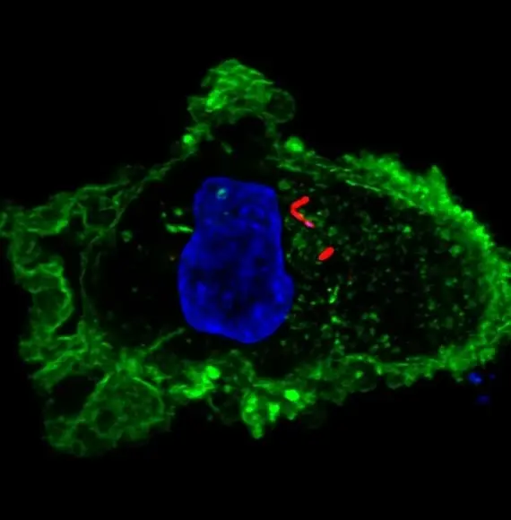cell outlined in green with a blue nucleus and a few tiny red lines showing the therapeutic proteins
