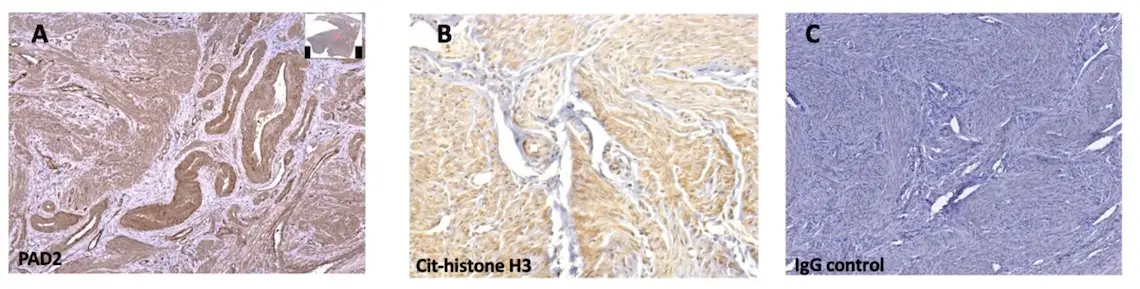 three abstract-looking tissue stains shown in purple, white, and shades of tan